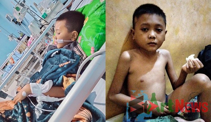 HMI Madina Advokasi Anak Menderita Kanker Darah dari Desa Sabajior