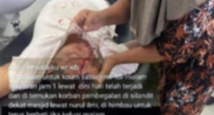 Ini Penjelasan Polres Padangsidimpuan Terkait Foto Pria Berlumur Darah yang Viral di Medsos