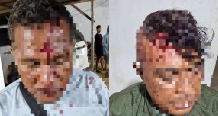 Unjuk Rasa Ricuh, Dua Petugas Keamanan PT Barapala Luka-luka