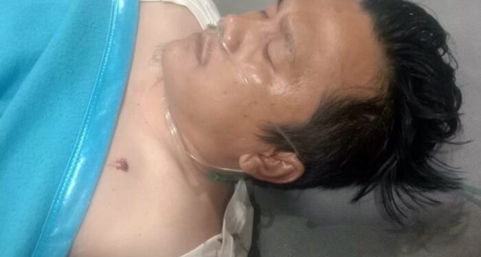 Oknum ASN Tembaki Warga Simalungun Pakai Airsoft Gun, Empat Orang Terluka