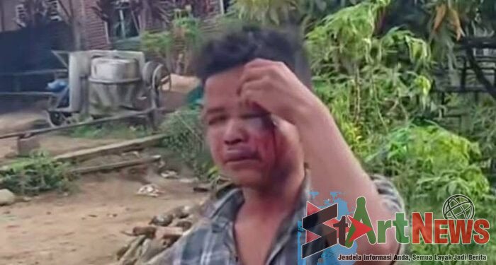 Pemuda Tapsel Babak Belur Dikeroyok 20 Orang di Simarsayang Padangsidimpuan