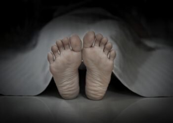 Istri yang Dibakar Suaminya di Paluta Akhirnya Meninggal Dunia