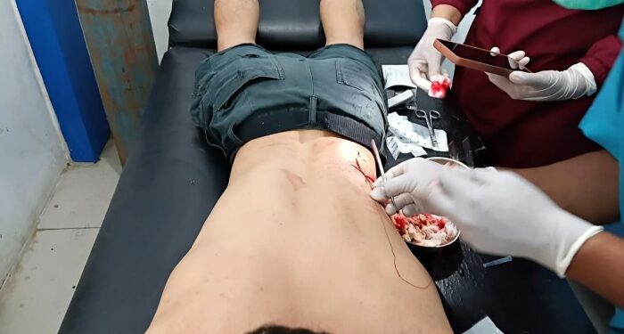 Kelompok Pemuda Mabuk Rusak Angkringan dan Bacok Warga di Wek II