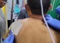 Anggota DPRD Madina Ditusuk Warga Saat Melayat di Siabu